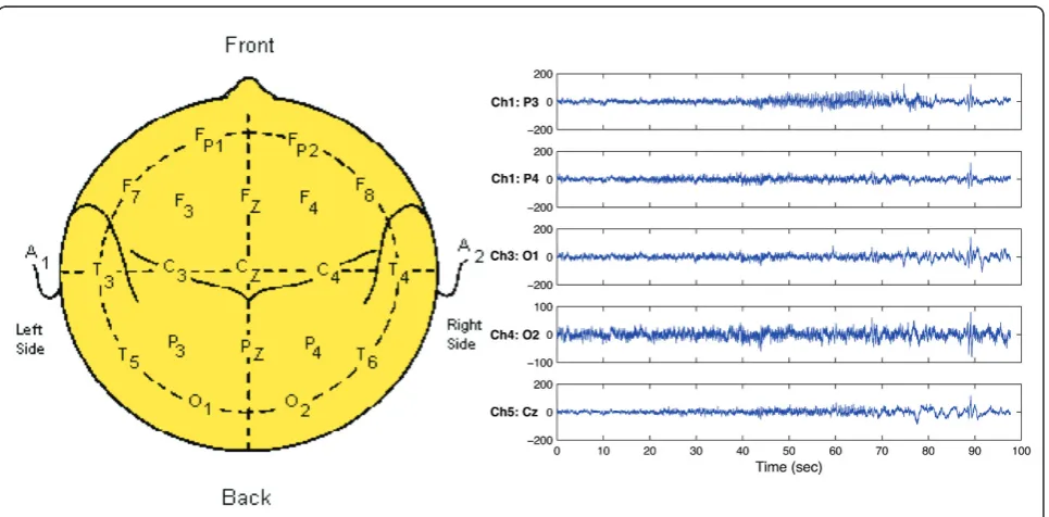 Figure 7 Cross-MST EEG. Cross-MST of the simulated EEG seizure showing the in-phase components (a) and the out-of-phase component (b).
