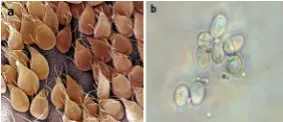Fig 2 (a) Trophozoites under electron microscopy. (b) Giardia cysts on microscopy