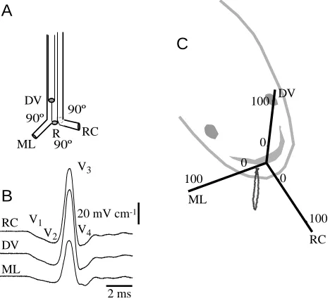 Fig. 1. Recording procedure. (A) The assembly of three activeelectrodes oriented along orthogonal axes (RC, rostro-caudal; DV,dorso-ventral; ML, medio-lateral) with their tips 2mm from theirintersection approximately where the fourth reference electrode (R