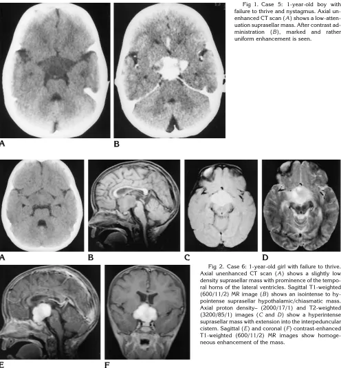 Fig 1. Case 5: 1-year-old boy with