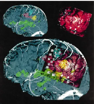 Fig 1. Patient P11.