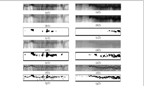 Figure 7 Diffusion results of the radiographic images: (a1, a2) defective radiographic images; (b1, b2) respective diffusion results using theP-M model; (d1, d2) respective diffusion results using the Shin-Du model; (f1, f2) respective diffusion results using the proposed model; (c1,c2), (e1, e2), (g1, g2) thresholding results using Otsu method.