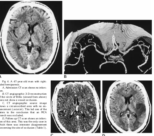 Fig 4. A 47-year-old man with right-