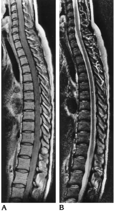 Fig 1. No abnormalities. Sagittal proton density–weighted