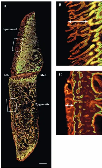 Fig. 6. Frontal section of a zygomatic archviewed under ultraviolet light (see Fig. 2 fororientation)