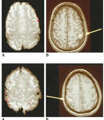 Fig 8. Functional MR imaging has a