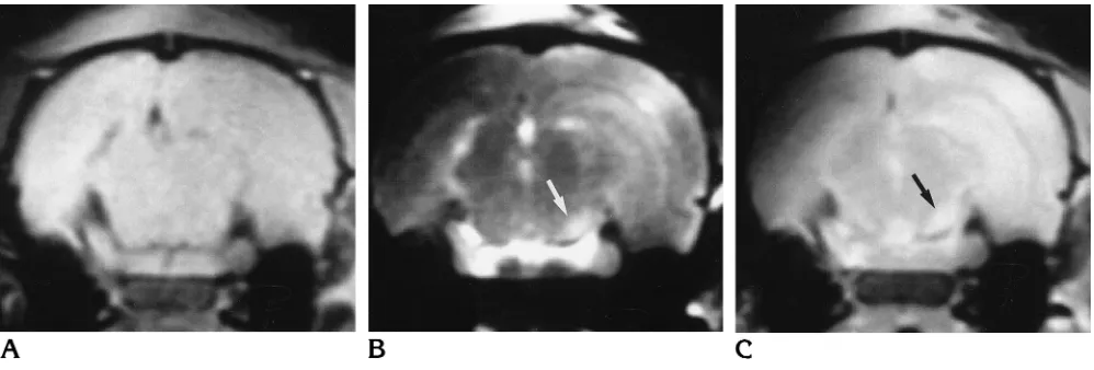 Fig 1. Coronal images of a rat brain 1 day after left MCA occlusion (animal 1).Ashown as high-intensity areas., T1-weighted image (600/20/2) reveals only slight signal asymmetry due to artifact (see text).B, T2-weighted image (2500/100/2) reveals a high-in