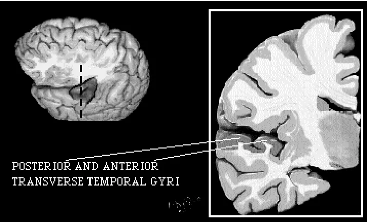 Fig 1. Illustration of the TTG