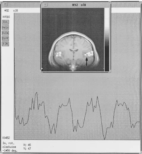 Fig 2. Signal intensity change over time is displayed in a