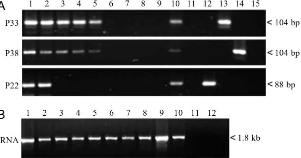 Fig. 2. Reverse transcription–polymerase chain reaction (RT-PCR)analysis of preCol-P variant expression