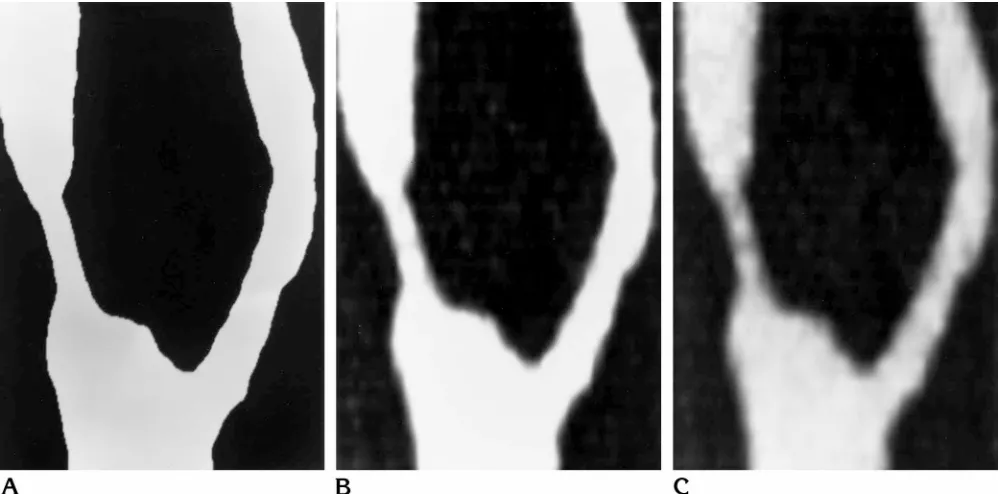 Fig 2. Maximum intensity projection images with various window settings but with level setting held constant.Anation., Optimal window setting, with window setting equal to zero