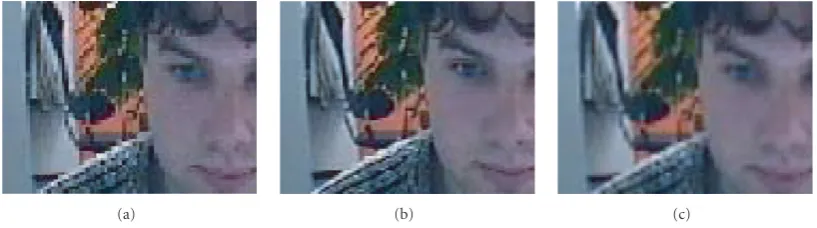 Figure 31: Enlarged detail of the Kantoor sequence with 10 output frames when four low-resolution frames are combined.
