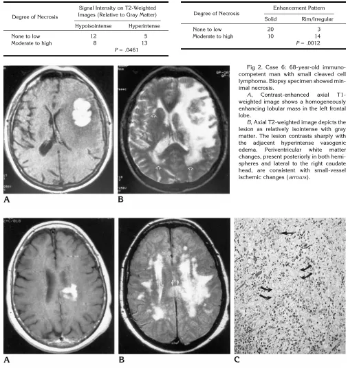 Fig 2. Case 6: 68-year-old immuno-