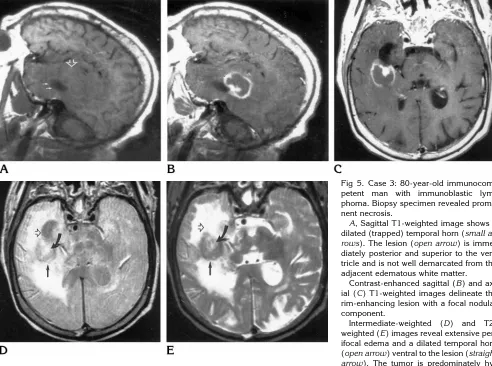 TABLE 5: Imaging findings: enhancement patterns