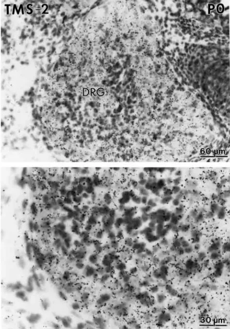 Fig. 7. Cellular distribution of TMS-2 mRNA in the dorsal rootganglion (DRG) of a 1-day-old mouse (PO)
