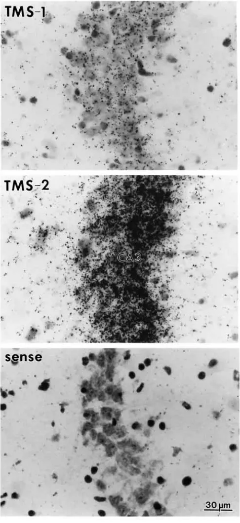 Fig. 6. Cellular distribution of TMS-2 mRNA in cortical layers I–IVof mouse brain. Hybridization and detection were performed asdescribed in Materials and methods