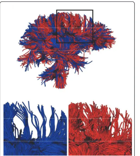 Figure 5 This is an example of the fiber bundles obtained frommodel is displayed in blue and the new model in red