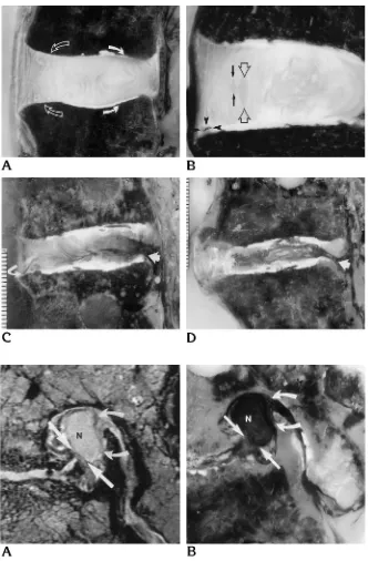 Fig 1. Parasagittal cryomicrotome sec-tions illustrating the four different types of