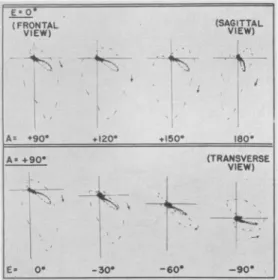 FIG. 6. Views of the spatial vectorcardiogram of a