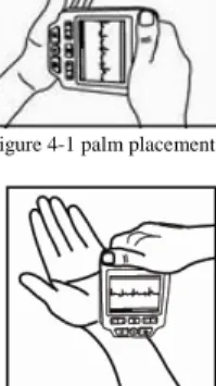 Figure 4-1 palm placement 