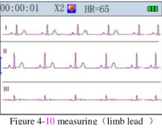 Figure 4-4 measuring（Ext.4） 