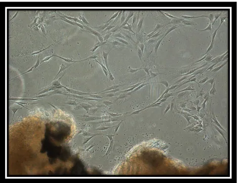 Figure 1: Phase contrast image of PDL tissue (Bottom) giving rise to PDL cells (top). 