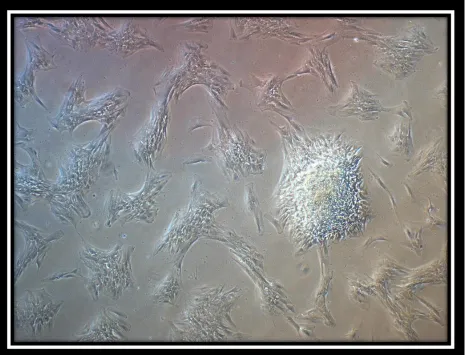 Figure 3: Phase contrast image of aged (P 11) STRO-1 positive bead-isolated cells. Note the changes in morphology from spindle shapes to more flattened shapes with increased cell volume