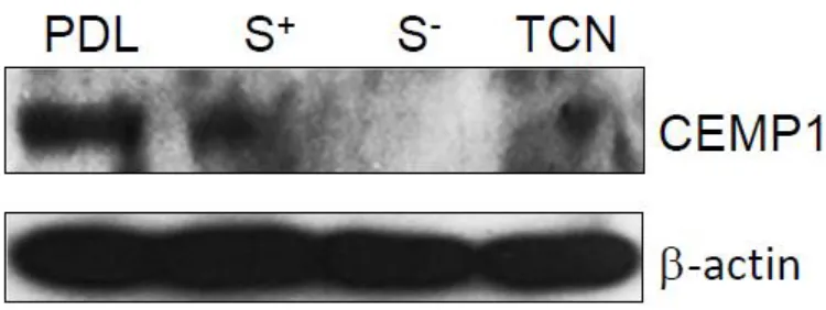 Figure 7: Protein expression by Western blot. Parental PDL (PDL), STRO-1 positive (S+), STRO-1 negative (S-), and cementoblastoma (TCN) cells assayed for CEMP1 expression and normalized to Beta-actin