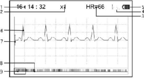 Figure 3-11 ECG Data Review Screen 