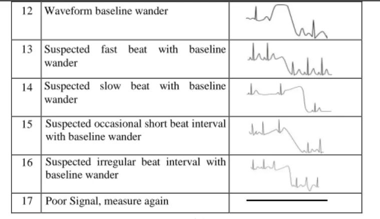 Table 3-1 12  Waveform baseline wander   