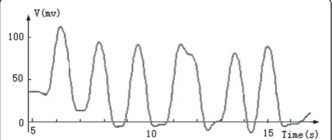 Figure 8 An example of synchronization and mode pulses. Thefirst 3 pulses are recognized as synchronization pulses, the forthpulse is the beginning of the mode section, and the last 2 pulsesreveal that the current data mode is mode 1.