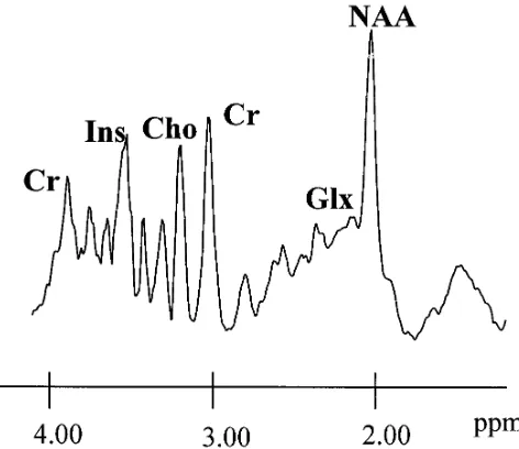 Fig 1. A proton MR spectrum (2000/25) obtained from the