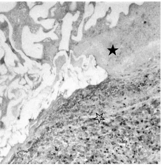 Fig 3. Photomicrograph shows an area of marked mural an-