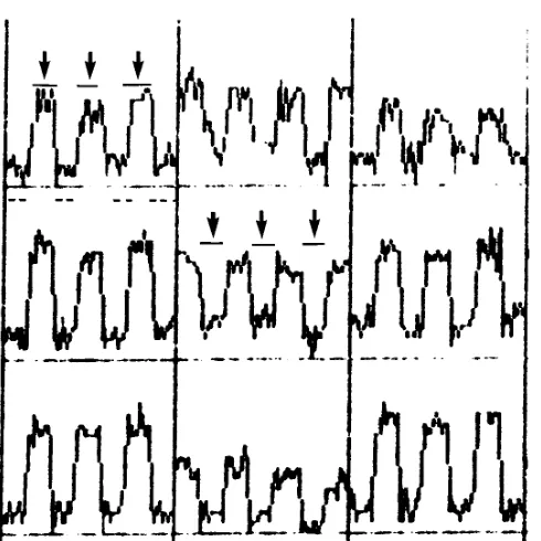 Fig 1. Time course plots for nine contiguous pixels at theperiphery of the phantom for a series of echo-planar images