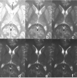 Fig 6. MR images of the brain at the