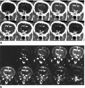 Fig 1. Temporal series of 1-sec-