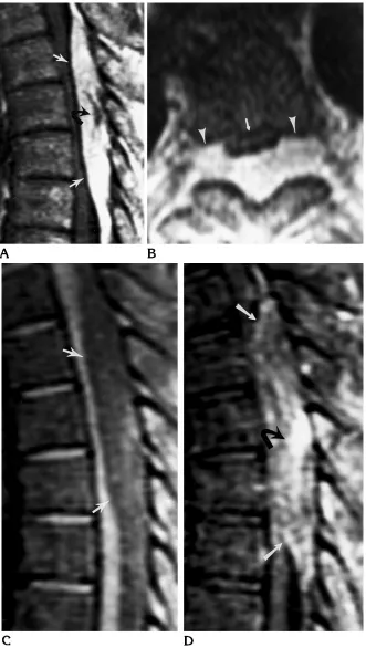 Fig 2. Patient 2: 61-year-old woman