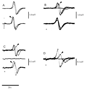 Fig. 8. (A) The externally recorded spongeaction potential ampliﬁed using adifferentiating circuit with a time constant ofapproximately 1s, i.e