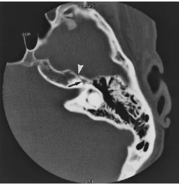 Fig 2. Autopsy photograph depicts the right middle cranial