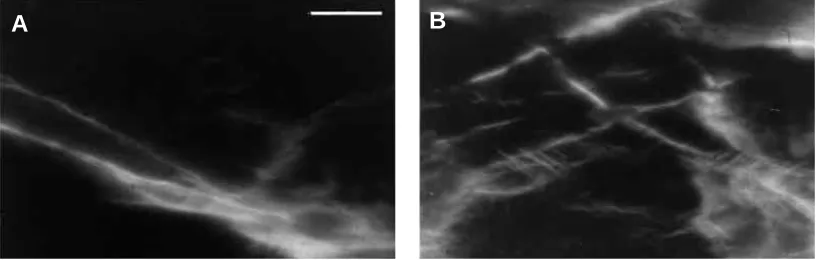 Fig. 5. Compression surfaces of specimens after failure. (A) An anterior specimen, (B) a posterior specimen