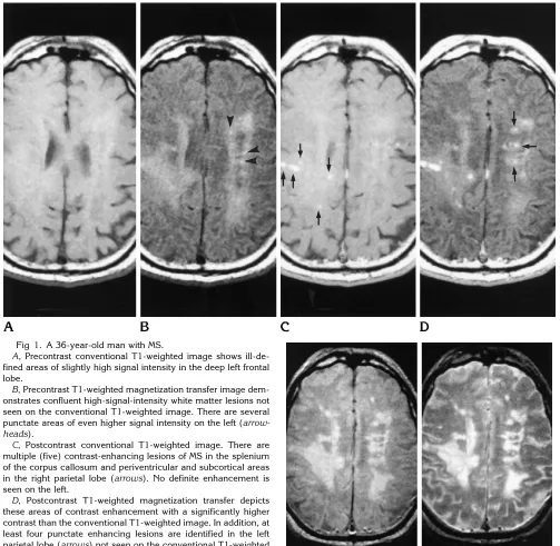 Fig 1. A 36-year-old man with MS.