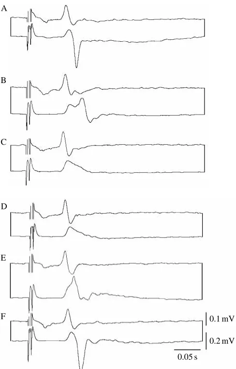 Fig. 7. Local ﬁeld potentials (LFPs) recorded from the olfactory lobefollowing single electrical stimuli of increasing intensity applied tothe exposed surface of the contralateral olfactory globular tract