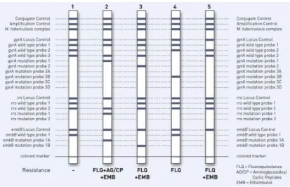 Figure 2.Examples of different GenoType® MTBDRsl strip readouts (Hain Life Sciences 2012b).