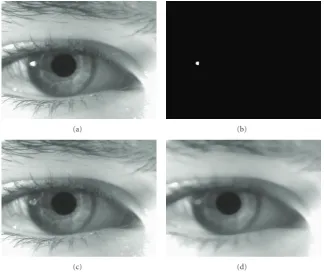 Figure 15: Here, we illustrate the steps to localize the limbic and pupillary boundaries