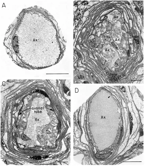 Fig. 3. Ultrastructural changes 16 days after axotomy. (A) The proximal stump of the axon 50µm proximal to the scar