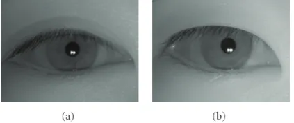 Figure 6: Examples of captured iris images.