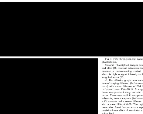 Fig 4. Fifty-three-year-old patient with