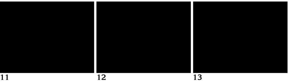 Fig 11. Scanning electron microscopy shows the neointima investing itself over and between the coils