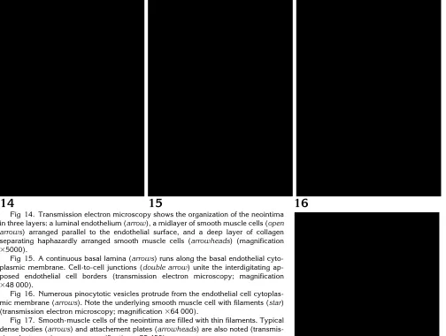 Fig 15. A continuous basal lamina (arrowsposed endothelial cell borders (transmission electron microscopy; magnification�plasmic membrane