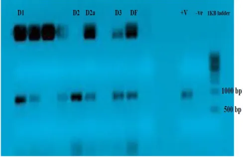 Fig. 3. Phylogenetic tree derived from 16S rDNA sequence of lactic acid bacteria Isolates  